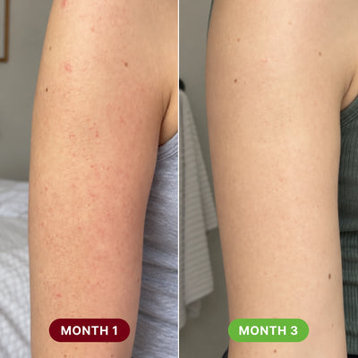 Dot Theory 2-Step System for Rough & Red Bumps