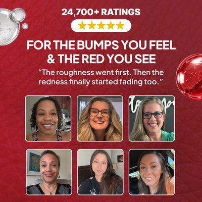 Dot Theory 2-Step System for Rough & Red Bumps